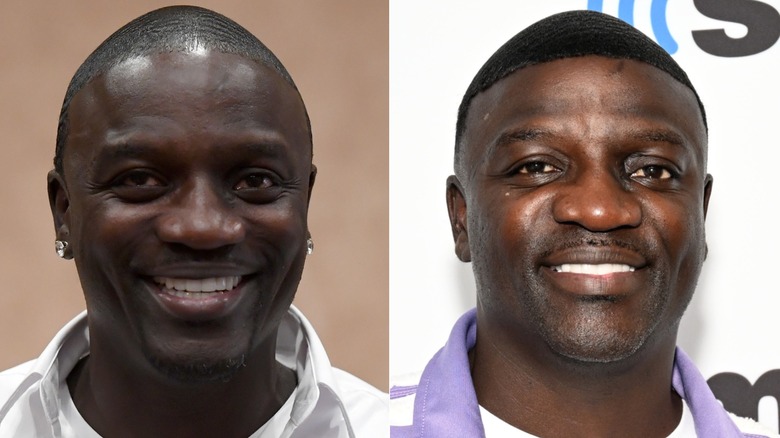 Recording artist Akon's hair upgrade exemplified