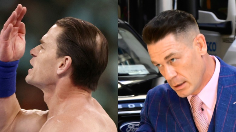 WWE Hall of Famer John Cena, with his bald spot and then, later, post-transplant
